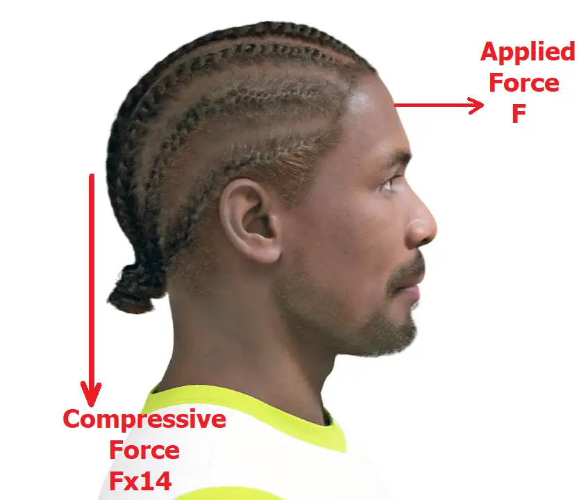 Diagram showing how a forward pulling force on the head is also off the spine's own axis and generates the same kind of compressive force down the cervical spine as a sideways pull